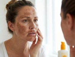 7 Bahaya Sinar UV yang Mengancam Ibu Hamil, Picu Melasma